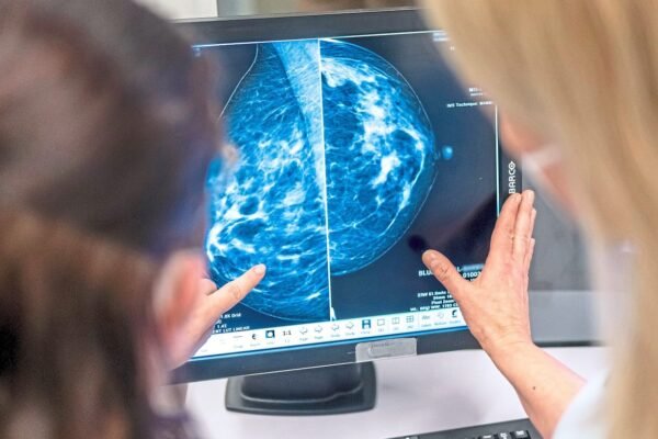 Perubahan gaya hidup dapat mengurangi risiko kanker payudara